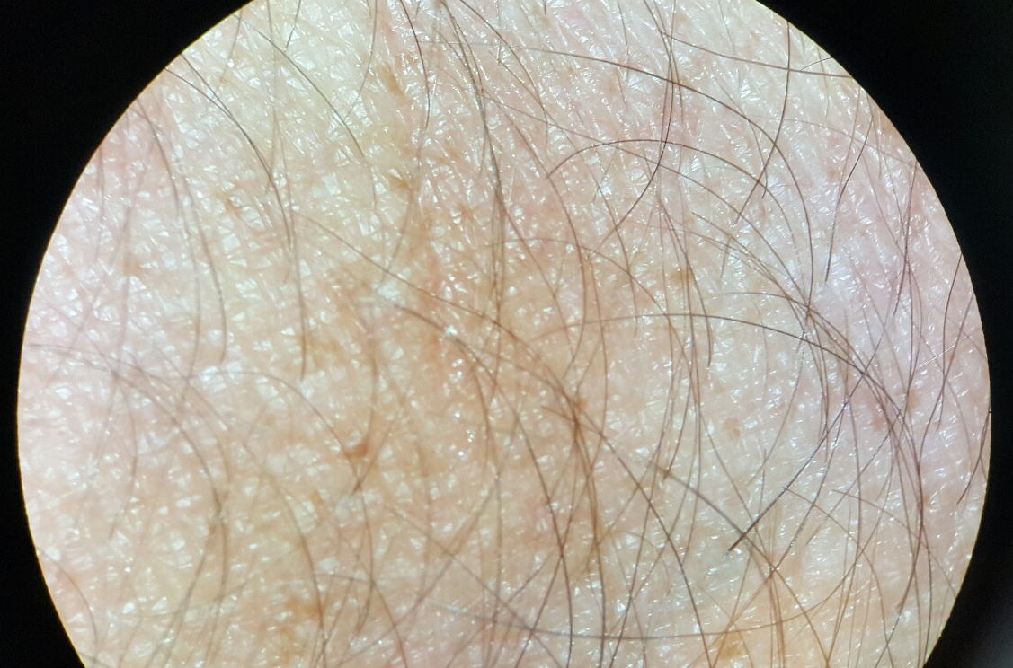 Skin pattern